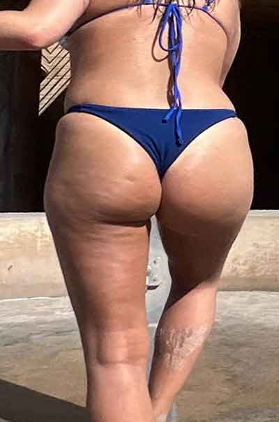 Lina, 35 år